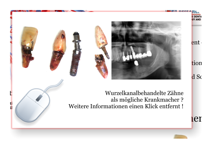 Wurzelkanalbehandelte Zähne  als mögliche Krankmacher ? Weitere Informationen einen Klick entfernt !